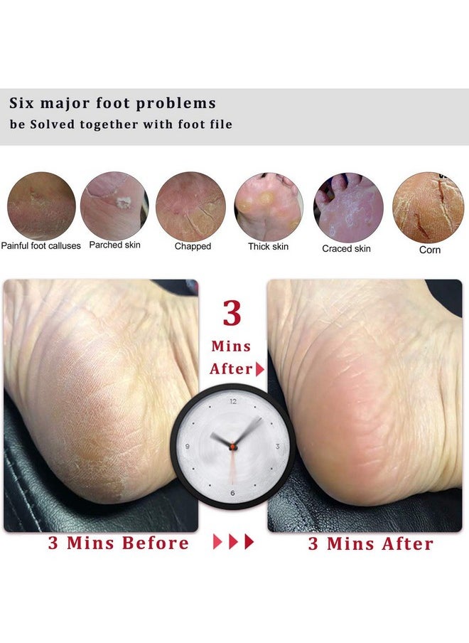 Kinepi Foot File Callus Remover Foot Scrubber,Professional Pedicure Foot Rasp Removes Cracked Heels,Dead Skin,Corn,Hard Skin,Pumice Stone for Scraper File Brush Tools for Wet and Dry Feet