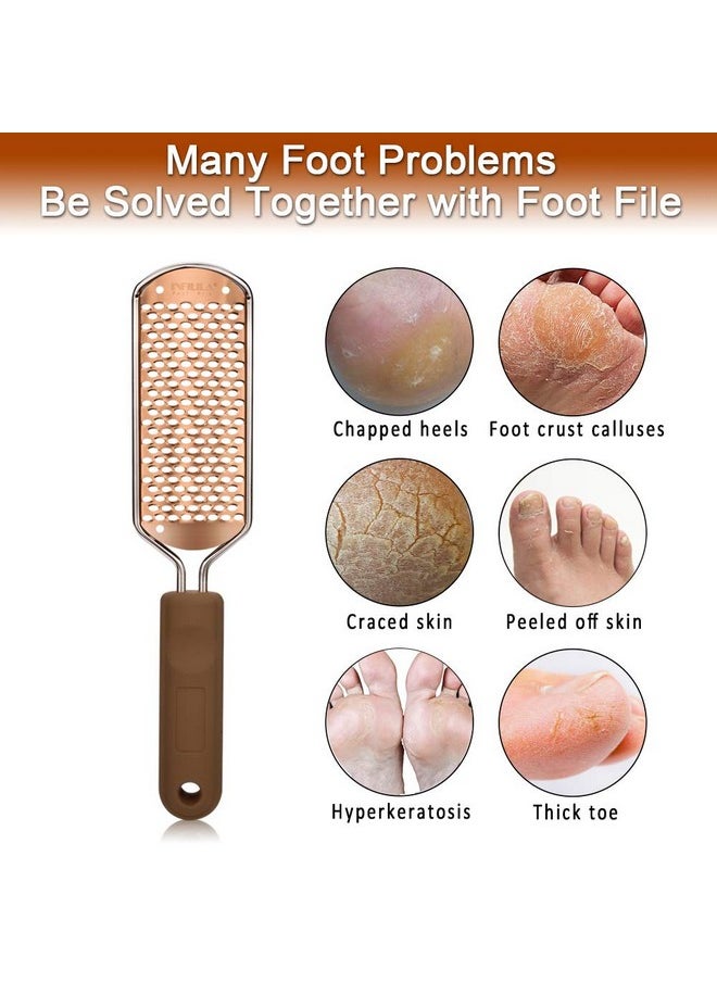 NXJ INFILILA Pedicure Foot File Callus Remover Foot Grater Professional Stainless Steel Callus Remover for Feet Heel Scraper for Feet Foot Scrubber for Dead Skin Foot File for Wet & Dry Feet