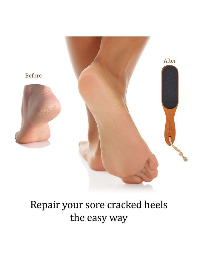 Pumice Stone Foot File - Wooden Pedicure Feet Scrubber with Handle for Callus, Dry, and Dead Skin Removal - Heel Scraper for Feet, Hands, and Body - Foot Filer for Use in Shower