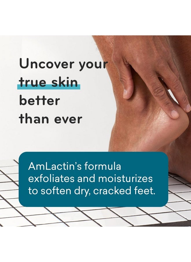 AmLactin Foot Repair Cream - 3 oz Foot Cream for Dry Cracked Heels with 15% Lactic Acid - Exfoliator and Moisturizer for Dry Skin & Foot Care (Packaging May Vary)