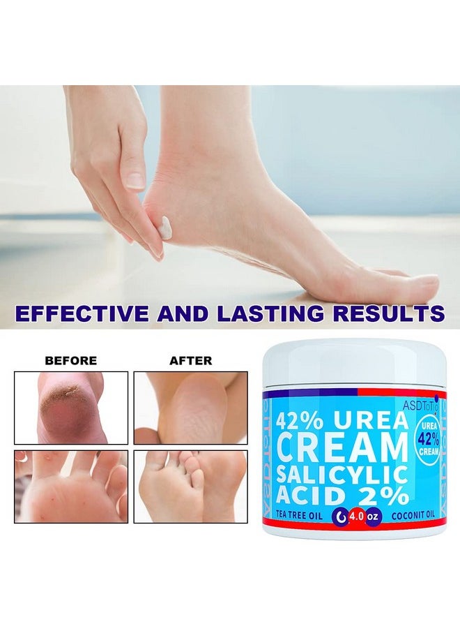 ASDToTio Urea Cream 42% - Premium Urea Foot Cream - With 2% Salicylic Acid, Tea Tree Oil, Shea Butter, Aloe Vera - For Feet, Hands, Heels, Elbows, Knees and More - 4 oz