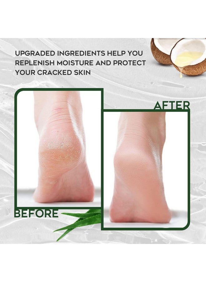Vebuni Urea Cream 42% Foot Cream Salicylic Acid 4 Oz, Upgraded Callus Remover For Feet, Knees& Elbows, Intensive Moisturizes & Softens Skin, Exfoliates Dead Skin