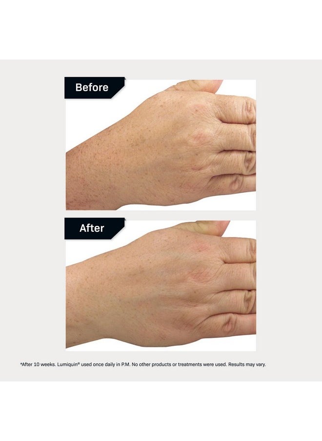 Revision Skincare Lumiquin® Hand Cream, Anti Aging Hand Moisturizer, Supports Moisture Barrier, Skin Brightening, 1.7 oz