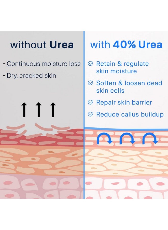 Ebanel Urea Cream 40% plus Salicylic Acid 2%, Foot Cream for Dry Cracked Heels Feet Knees Elbows Hands, Foot Dead Skin Cuticle Callus Remover Toenail Softener, Keratolytic Skin Barrier Repair Cream