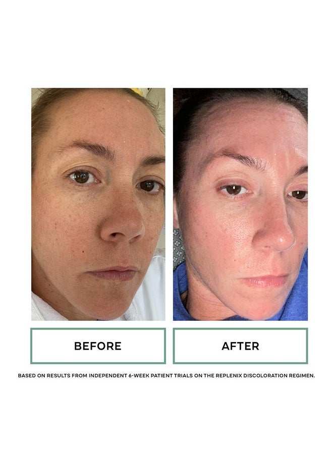 Replenix - Glycolix Elite Glycolic Acid Resurfacing Peel Pads - Medical Grade Brightening and Exfoliating Treatment, Travel Friendly Pads, 60 ct.