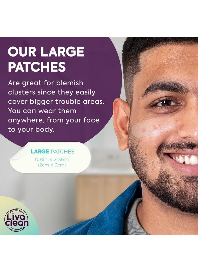 LivaClean 50CT Large Hydrocolloid Acne Patches - for Pore Spots Nose Face Cystic Pimple Zit Patch - Big Pimple Patches Hydrocolloid Bandages Strips Stickers Pimple Patch XL Large Acne Patch Large