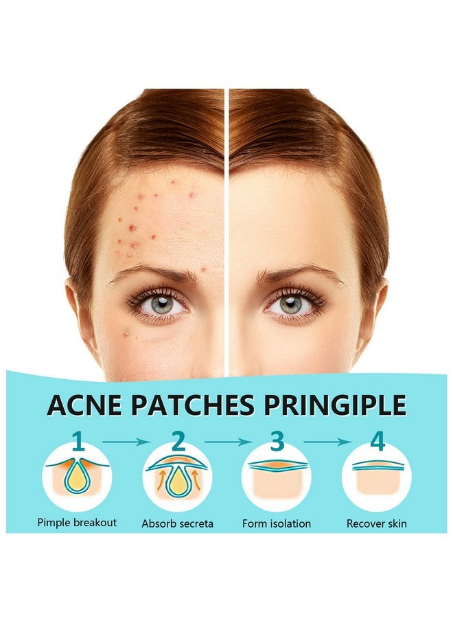 180 Counts Pimple Patches for Face Hydrocolloid Acne Patches for face Invisible Zit Patches for Face Pimple Patch Acne Spot Treatment Patch Blemish Patches Cover Patches Stickers