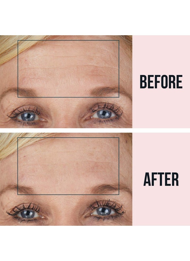 SiO Beauty BrowLift Forehead Anti-Wrinkle Patch - Rapid Overnight Reusable Silicone Patch to Reduce Furrows, Expression Lines, and Creases