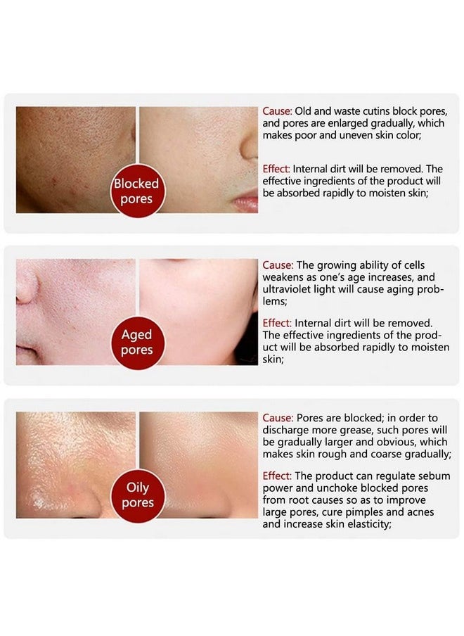 LANBENA Pore Skin Care Serum Facial Essence, Minimize Enlarged Pores, for Tightening Pores, Shrinking Pores + Relieving Dryness + Oil Control Firming + Moisturizing (New Packing)