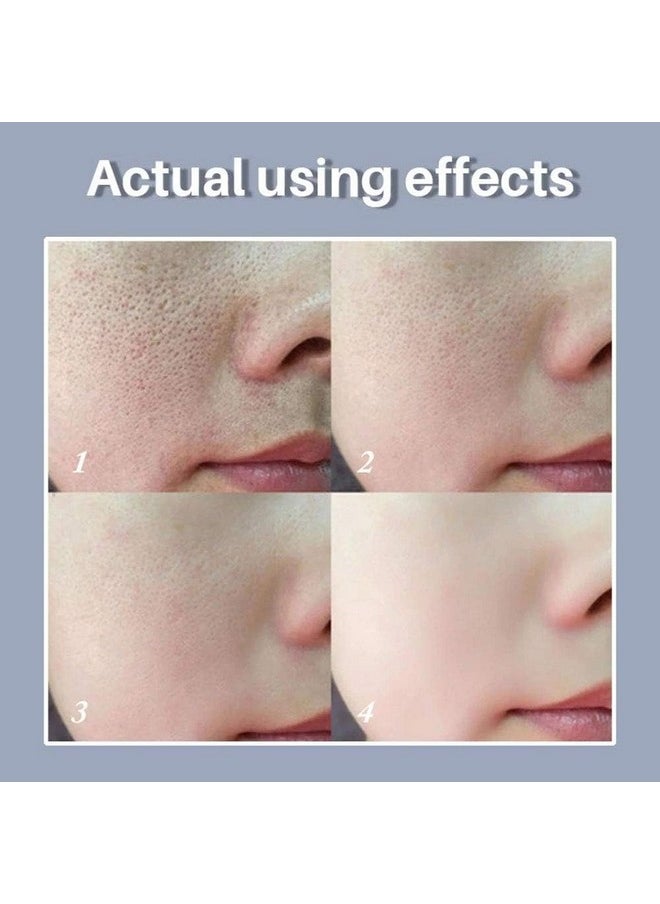 LANBENA Pore Skin Care Serum Facial Essence, Minimize Enlarged Pores, for Tightening Pores, Shrinking Pores + Relieving Dryness + Oil Control Firming + Moisturizing (New Packing)