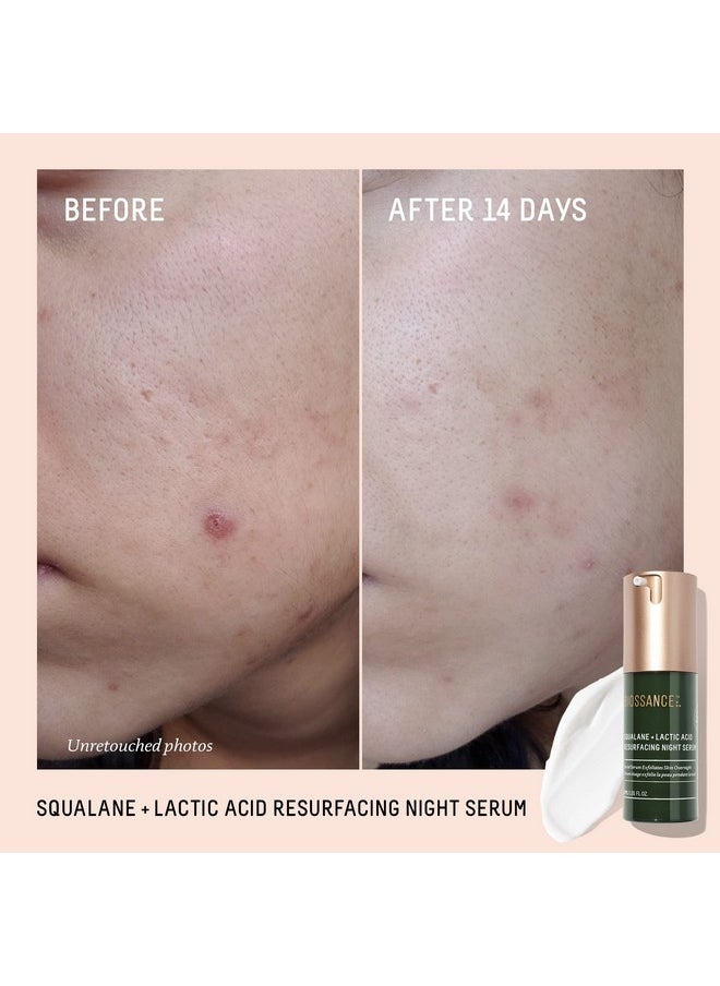 BIOSSANCE Squalane + Lactic Acid Resurfacing Night Serum - Vegan 10% Lactic Acid Face Serum for Skin Texture and Fine Lines - Gentle Night Exfoliant, Hydrating - Pore Reducer for Face, 1.0 Ounce