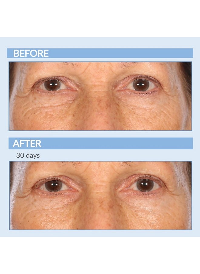 Serious Skincare Anti-Aging A Force XR Retinol Serum Concentrate for Face - Vitamin A, C and Glycolic Acid - For Smoothing Lines, Wrinkles and Large Pores - Resurface and Hydrate Skin - 1 Fl. Oz.