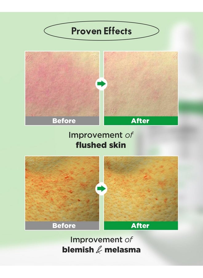 WELLAGE Real Cica Calming Trouble Ampoule - Korean Soothing Serum 95% Madecassoside, Rapid Soothing, Redness Relief, Sebum Control, Improves Freckles and Blemishes, for Acne-Prone Skin, 1.69 fl.oz