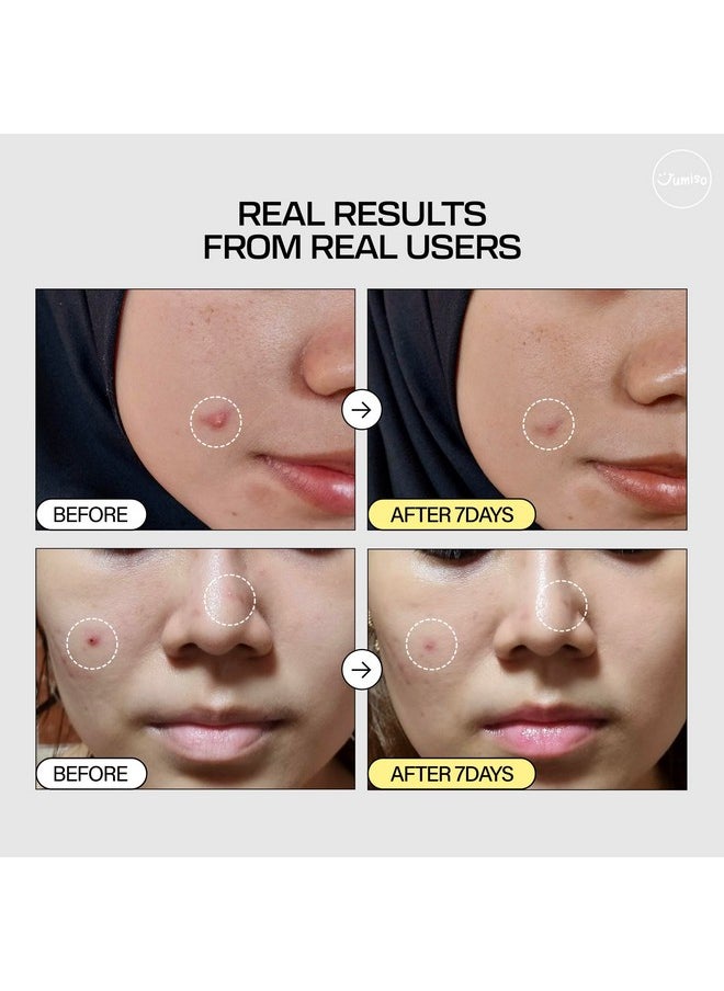 JUMISO Snail Mucin 95% + Peptide Essence 4.73 fl.oz / 140ml | Hydrating Serum with Snail, Face Moisturizer for Dry Skin, Daily Deep Hydration, Korean Skincare