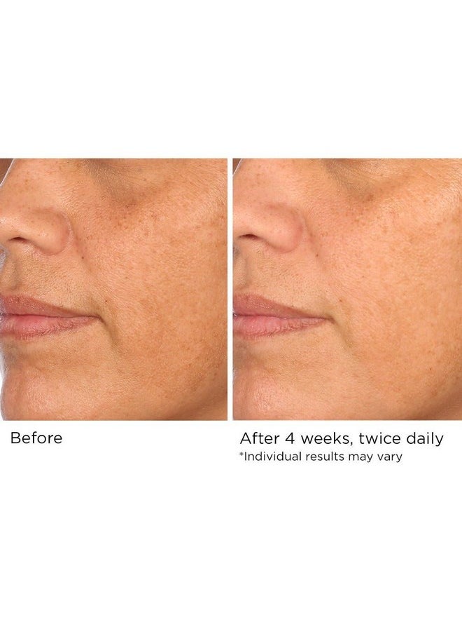 NassifMD Hydro-Screen - Clinical Grade Serum with Premium Ingredients: Ceramides, Retinol, Bakuchiol, Hyaluronic Acid - Anti Aging Treatment