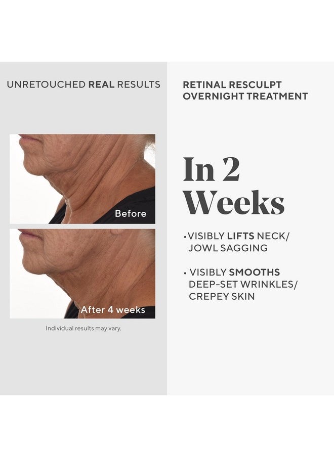 Murad Retinal ReSculpt Overnight Treatment - Advanced Anti-Aging Serum for Lines and Wrinkles - Encapsulated Vitamin A Skin Care for Smoothing, Firming and Lifting Face and Neck, 1.0 Fl Oz
