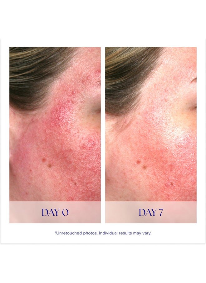 iS Clinical Pro-Heal Serum Advance+ antioxidant-rich serum containing vitamin C, E, and A for redness, rosacea, inflammation, 0.5 Fl Oz