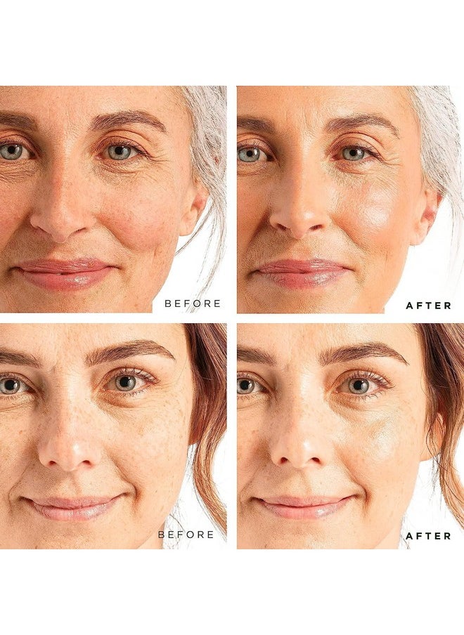 Tree of Life Beauty Facial Skin Care Set, Brightening, Firming, Hydrating, Dry Face, Dermatologist Tested - Retinol Serum and Hydrating Hyaluronic Acid - Skin Care Kit, 2 count of 1 Fl Oz