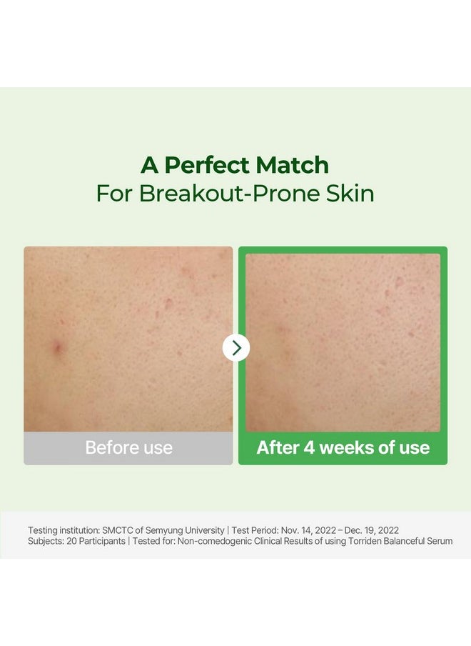Torriden BALANCEFUL Cica Serum, Facial Essence that Instantly Hydrates, Balances, Soothes and Calms with 5 Different Centella Asiatica Extract for Oily, Combo, and Sensitive Skin