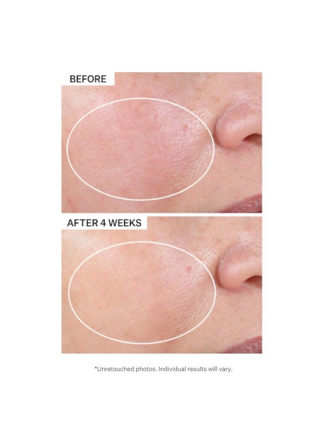 StriVectin Advanced Retinol Intensive Night Moisturizer, Targets Visible Signs of Aging for Healthier Skin, 1.7 Fl Oz