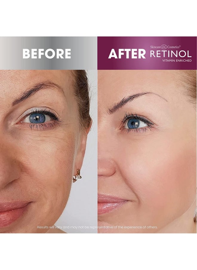 Retinol Anti-Aging Cleansing Towelettes - All-in-One Cleanser, Toner & Makeup Remover in a Convenient Pre-Moistened Wipe - On-The-Go Exfoliating, Toning & Hydrating Leaves Skin Clean, Fresh & Refined