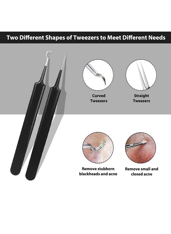 Glamne Blackhead Remover Pimple Popper Kit Acne Comedone Extractor Blemish Extraction Popping Tools (Black)