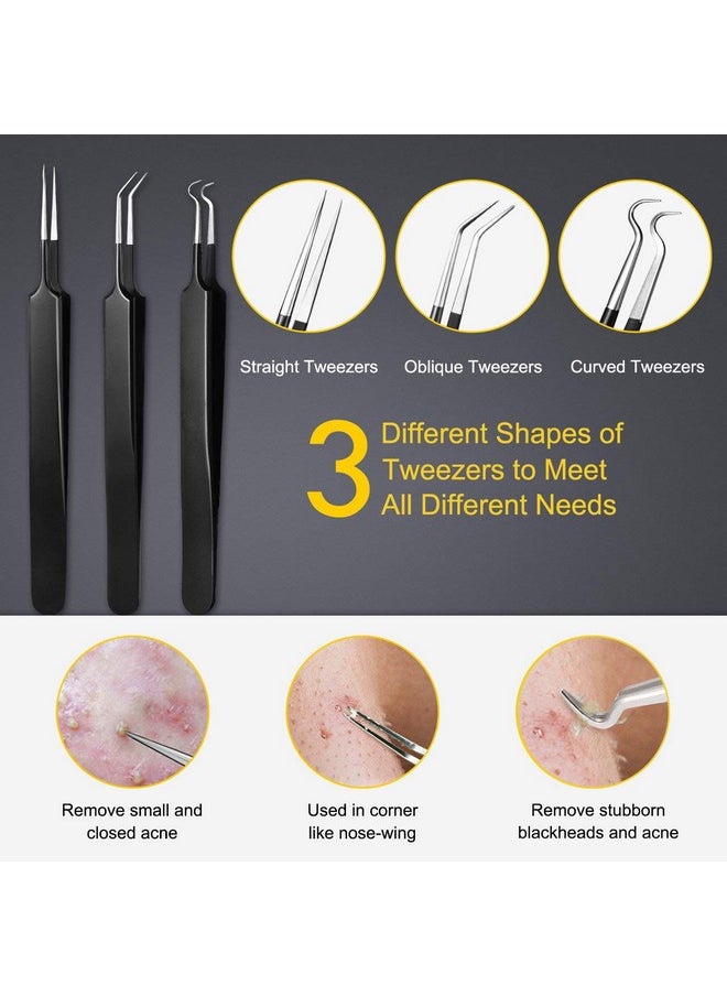 Pimple Popper Tool Kit - Boxoyx 10 Pcs Blackhead Remover Comedone Extractor Kit with Box for Quick and Easy Removal of Pimples, Blackheads, Zit Removing, Forehead,Facial and Nose (Black)