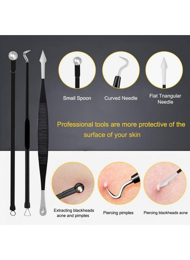Pimple Popper Tool Kit - Boxoyx 10 Pcs Blackhead Remover Comedone Extractor Kit with Box for Quick and Easy Removal of Pimples, Blackheads, Zit Removing, Forehead,Facial and Nose (Black)