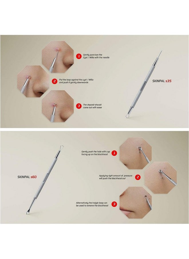 Suvorna Skinpal Pimple Popper Tool Kit | Milia Remover | Lancets for Facial Extraction | Whitehead Extractor Tool | Comedone Extractor | Blackhead Remover Tool | Acne Needle Tool & Cyst Removal Tool.