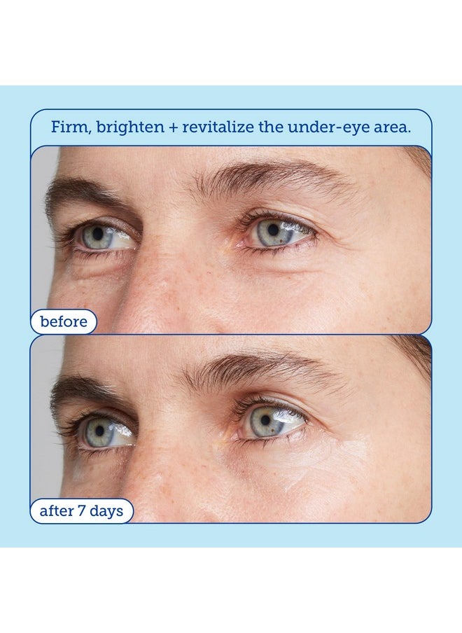 Skinfix Barrier+ Triple Lipid Eye Treatment: Infused with Caffeine, Niacinamide, and Peptides for Depuffing, Tightening, and Under-Eye Brightening, 15 ml