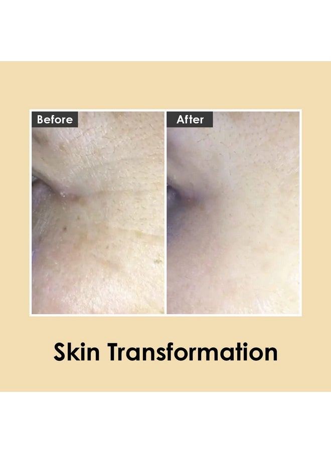 Medi-Peel Peptide9 Hyaluronic Volumy Eye Cream, Anti-Aging, Brightening, Reduces Wrinkles, Under Eye Bags, Dark Circles & Puffiness Care, Hyaluronic Acids, Enhance Elasticity, Korean Skin Care