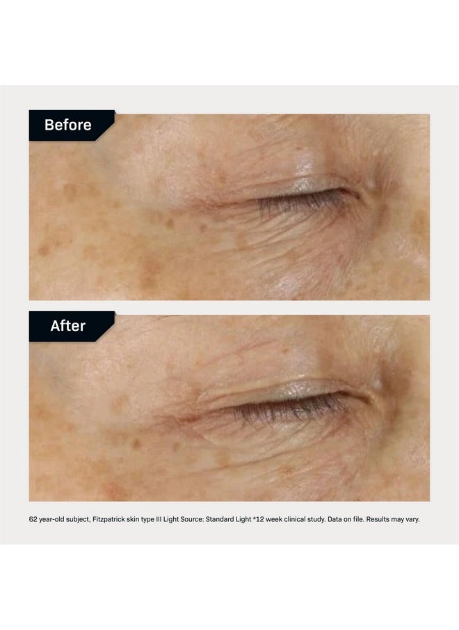 Revision Skincare D·E·J Eye Cream®, Firming and Moisturizing Treatment for Fine Lines, Wrinkles and Crow’s Feet, 0.5 fl oz