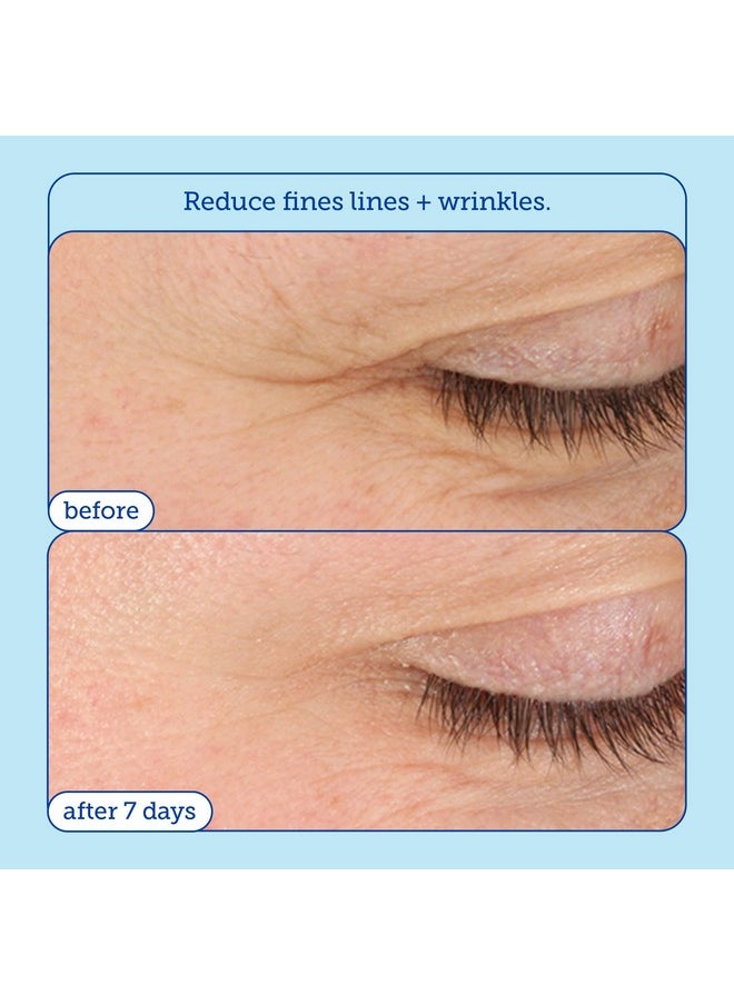 Skinfix Barrier+ Triple Lipid-Boost 360° Eye Cream: Targets Dark Circles, Puffiness, and Fine Lines Around Eyes and Lids, Clinically Proven to Brighten and Refresh Eyes, 0.5 oz
