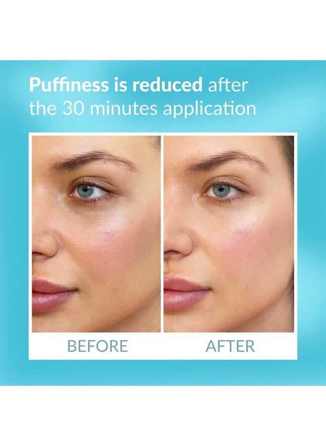 Talika Eye Therapy Patch - Instant Smoothing Under Eye Patches - Mask For Dark Circles Puffiness & Tired Eyes - 6 Refills Reusable Under Eye Patches for Adults Skincare Eye Treatment