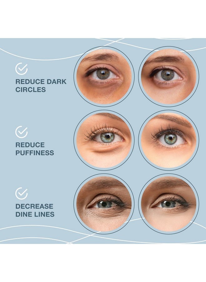 Under Eye Patches for Puffy Eyes and Dark Circles - 24k Gold Under Eye Mask Patches for Puffiness, Beauty & Personal Care Products - Under Eye Masks 20 Pairs Gold Under Eye Patches for Puffy Eyes