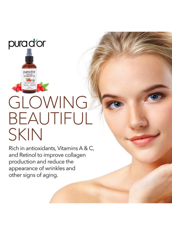 PURA D'OR 4 Oz ORGANIC Rosehip Seed Oil Hair Relaxer 100% Pure Cold Pressed USDA Certified All Natural For Anti-Aging, Scar Treatment, Face, Hair Relaxer & Skin Moisturizer - Women & Men