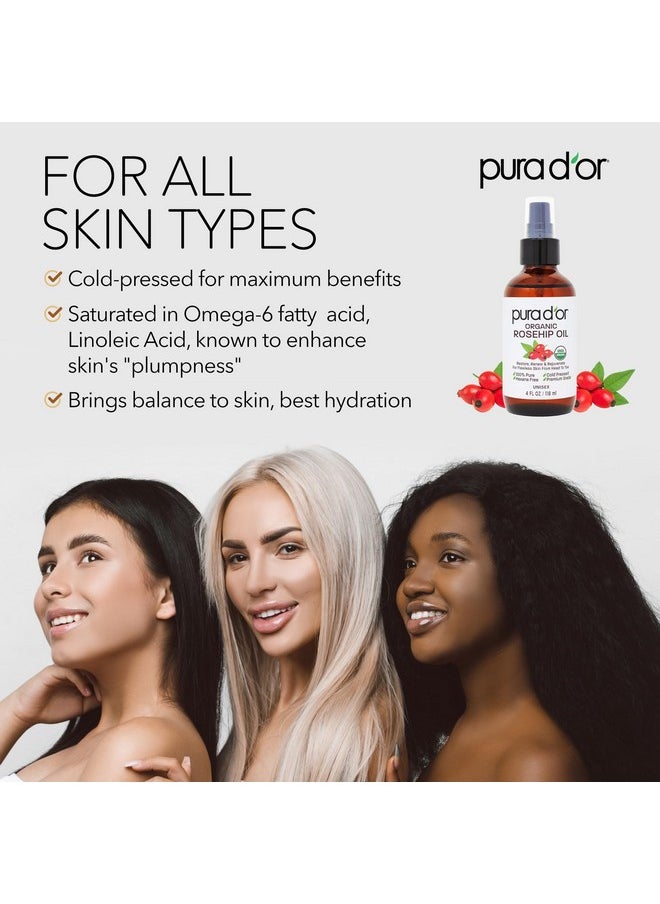 PURA D'OR 4 Oz ORGANIC Rosehip Seed Oil Hair Relaxer 100% Pure Cold Pressed USDA Certified All Natural For Anti-Aging, Scar Treatment, Face, Hair Relaxer & Skin Moisturizer - Women & Men