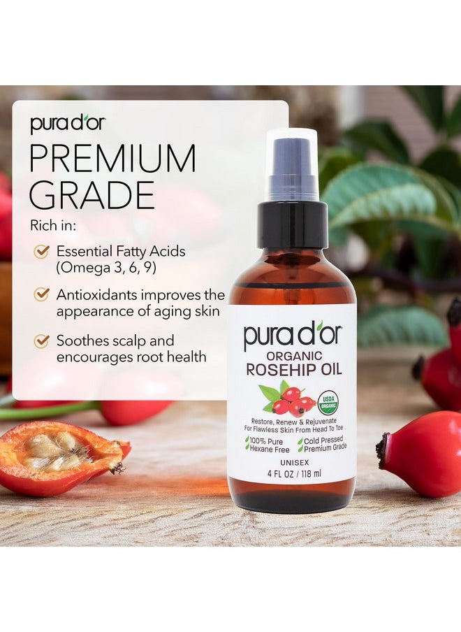 PURA D'OR 4 Oz ORGANIC Rosehip Seed Oil Hair Relaxer 100% Pure Cold Pressed USDA Certified All Natural For Anti-Aging, Scar Treatment, Face, Hair Relaxer & Skin Moisturizer - Women & Men