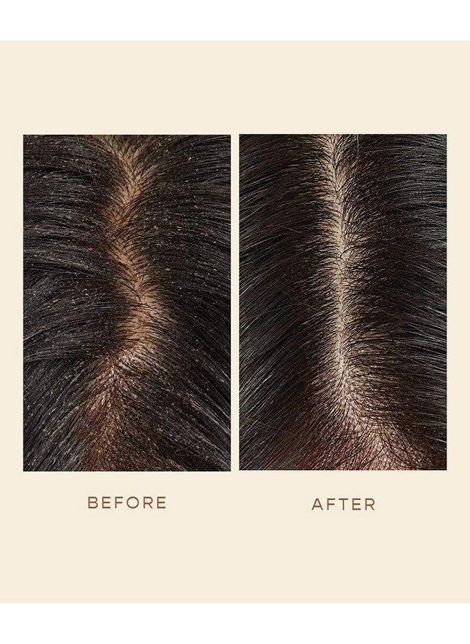 VEGAMOUR GRO Scalp Detoxifying Serum, Scalp Serum with Zinc PCA Removes Buildup & Soothes Scalp, Natural Citrus Scent, 2 fl. oz.