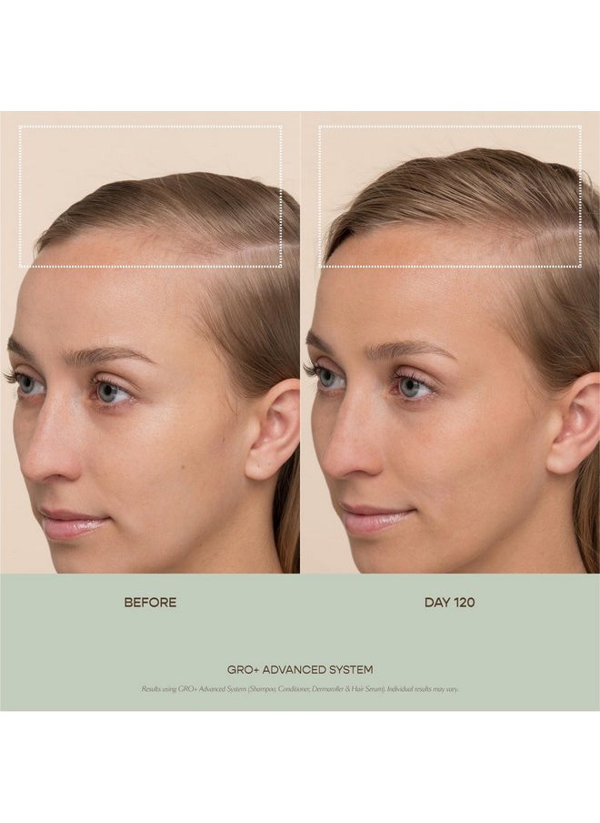 VEGAMOUR GRO+ Advanced Dermaroller | 1,200 Microneedle 0.25mm Scalp Tool | Gently Exfoliates the Scalp | Wide Head for Maximum Coverage