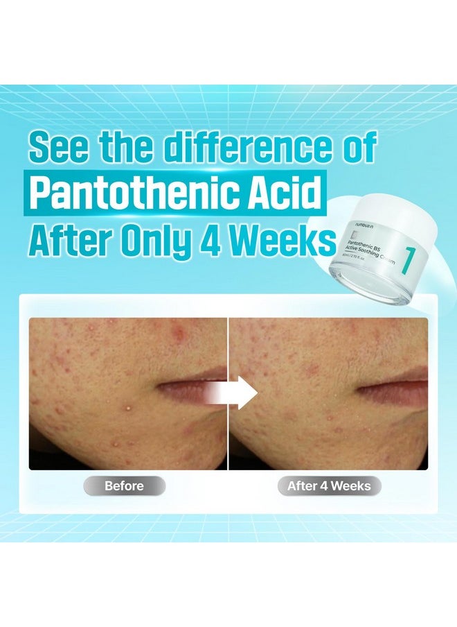 numbuzin No.1 Pantothenic B5 Active Soothing Cream | Lightweight Hydrating Moisturizer, Pantothenic Acid, Niacinamide, Panthenol | Excess Oil Control, Soothes Acne | Non-Comedogenic | 2.70 fl. oz.