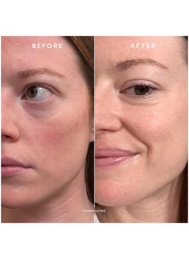 True Botanicals - Chebula Extreme Cream | Non-Toxic, Cruelty-Free | Anti-Aging Moisturizer | Hyaluronic Acid | Targets Fine Lines & Wrinkles for Dry and Sensitive Skin | MADE Safe (1.7 fl oz | 50 ml)