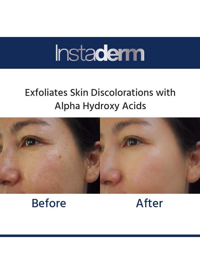 Glycolic Acid 15% Anti-Aging Cream- Alpha Hydroxy Facial Moisturizer Reduces the Appearance of Fine Lines, Wrinkles, Age Spots, Dark Spots & Scars. Exfoliates & Smoothes Skin Texture & Tone.