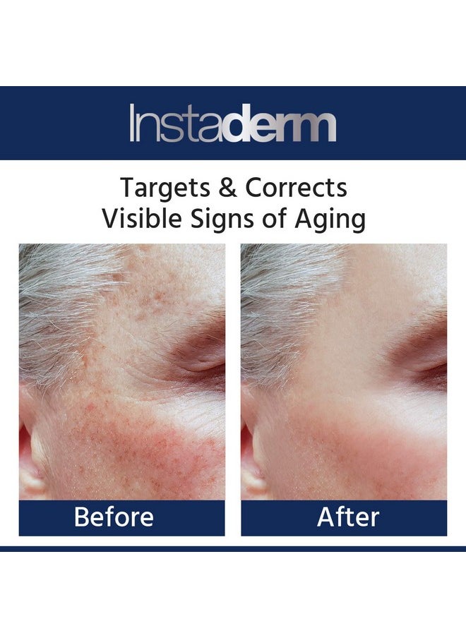 Glycolic Acid 15% Anti-Aging Cream- Alpha Hydroxy Facial Moisturizer Reduces the Appearance of Fine Lines, Wrinkles, Age Spots, Dark Spots & Scars. Exfoliates & Smoothes Skin Texture & Tone.