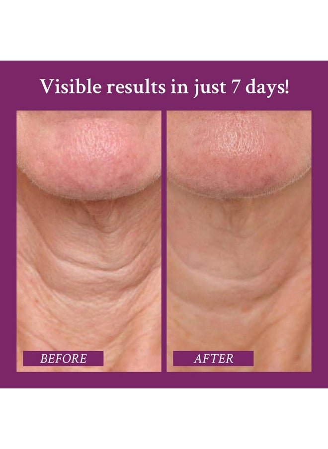 PRAI Neck Creme for Tightening & Firming Beauty | Neck Firming Cream That Boosts Elasticity | Cruelty & Paraben-Free Vegan Neck Tightening Cream | Neck and Chest Firming Cream With Hyaluronic Acid