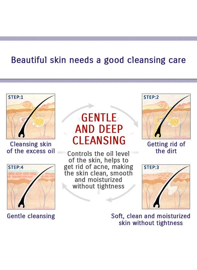 BIOAQUA Face Skin Care Acne Anti-Wrinkle Removal Cream Spots Scar Blemish Marks 100g