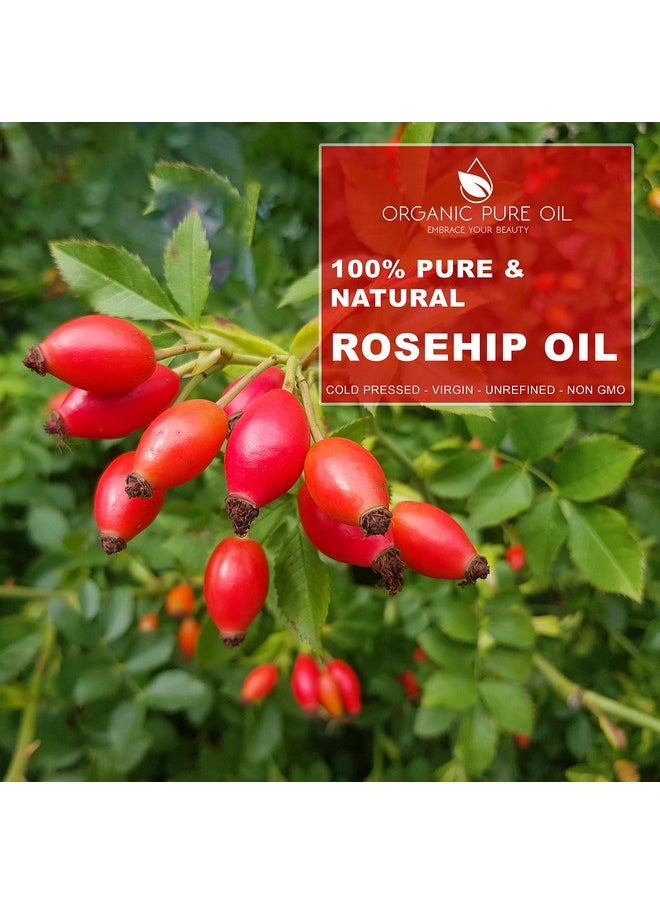 OPO Rosehip Oil - 8 oz - 100% Pure, Unrefined, Non GMO, Cold Pressed, Vegan Carrier Oil for Face, Hair, Skin, Nails, Body Aging Skin Beard Locs Mustache Lashes - Premium Grade - Packaging May Vary