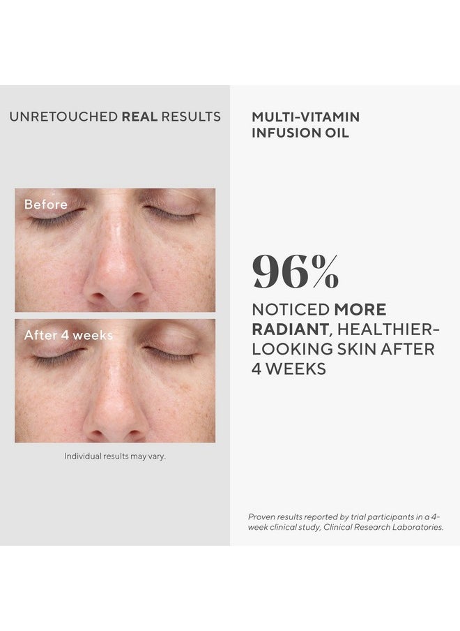Murad Multi-Vitamin Infusion Facial Oil - Hydration Absorbs Quickly and Moisturizes with Vitamins A-F - Anti-Aging Skin Treatment Backed by Science