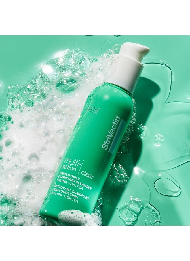 StriVectin Multi-Action Clear Gentle Daily Clarifying Cleanser for Acne Blemished Skin and Break Outs, 5 fl oz