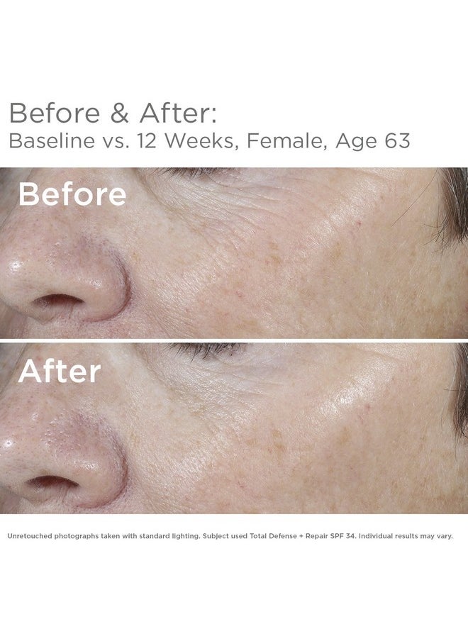 SkinMedica Total Defense + Repair SPF 34 Sunscreen for Face. This Lightweight, Facial Sunscreen is Ideal for Oily and/or Combination Skin, 2.3 Oz
